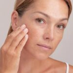 Cele mai bune Creme pentru Pete Pigmentare si Melasma Informatii Utile